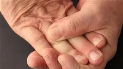 أسباب وعلاج تنميل اليدين والقدمين