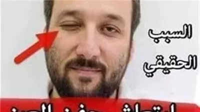 هل تعلم على ماذا يدل إرتجاف العين ما الذي يحاول أن يقوله لك جسـمك