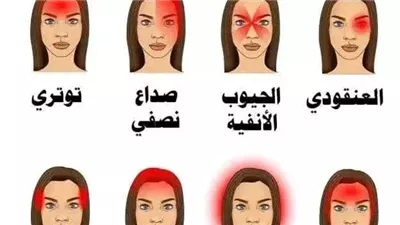 انواع الصداع