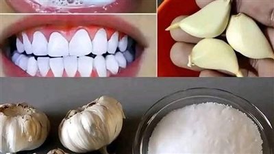 وصفة لعلاج الأسنان في البيت
