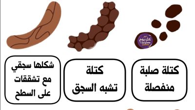 أشكال البراز ومعانيها الصحية دليل شامل لفهم إشارات الجهاز الهضمي